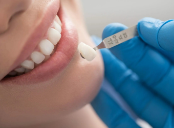 Signs a Tooth May Need Crown